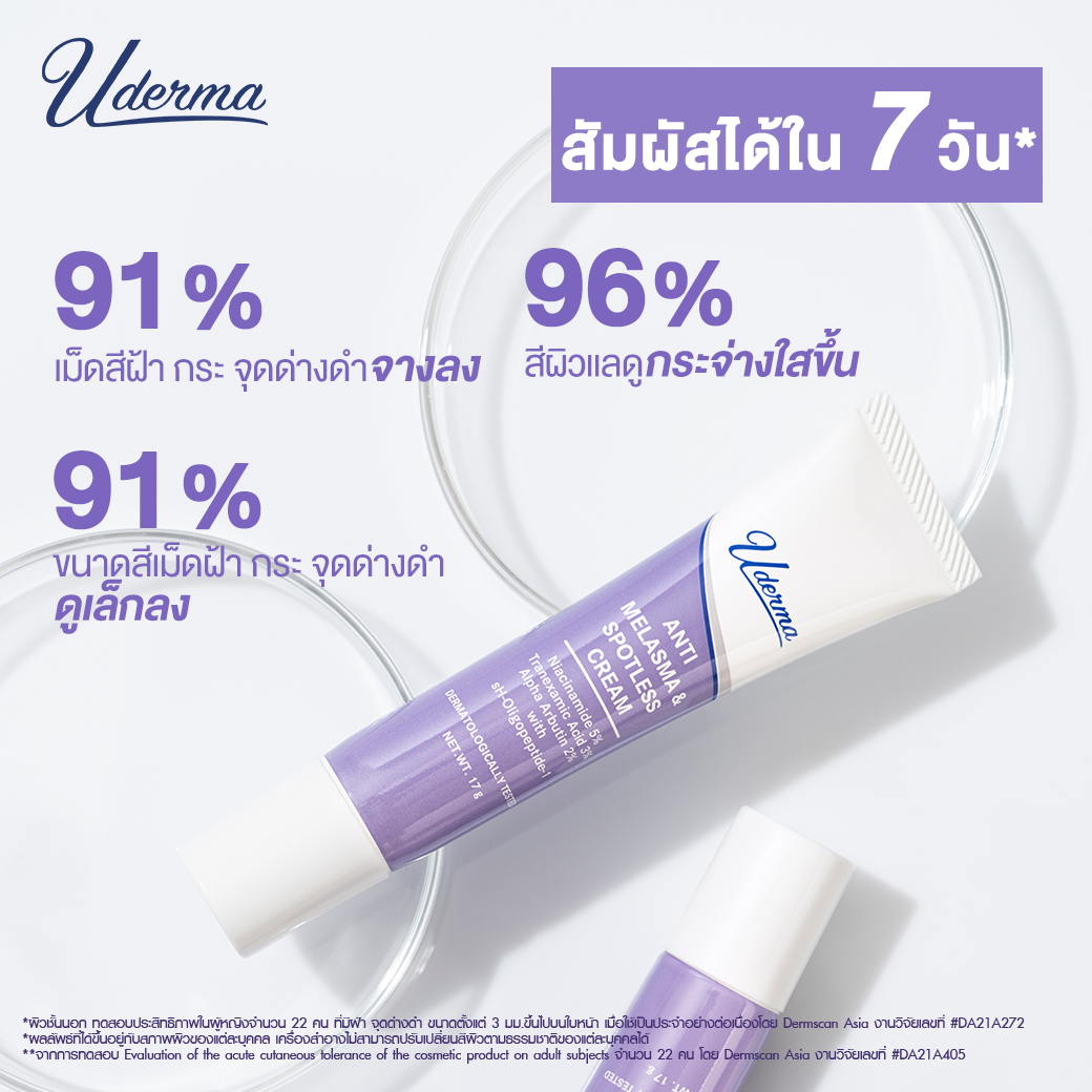 Uderma Anti-Melasma & Spotless Cream 5g. (ไซส์ขนาดทดลอง) นวัตกรรมที่รวบรวมครบทุกสารสำคัญที่แพทย์ผิวหนังแนะนำ ให้คุณได้เคลียร์ฝ้าอย่างปลอดภัย จบทุกขั้นตอน